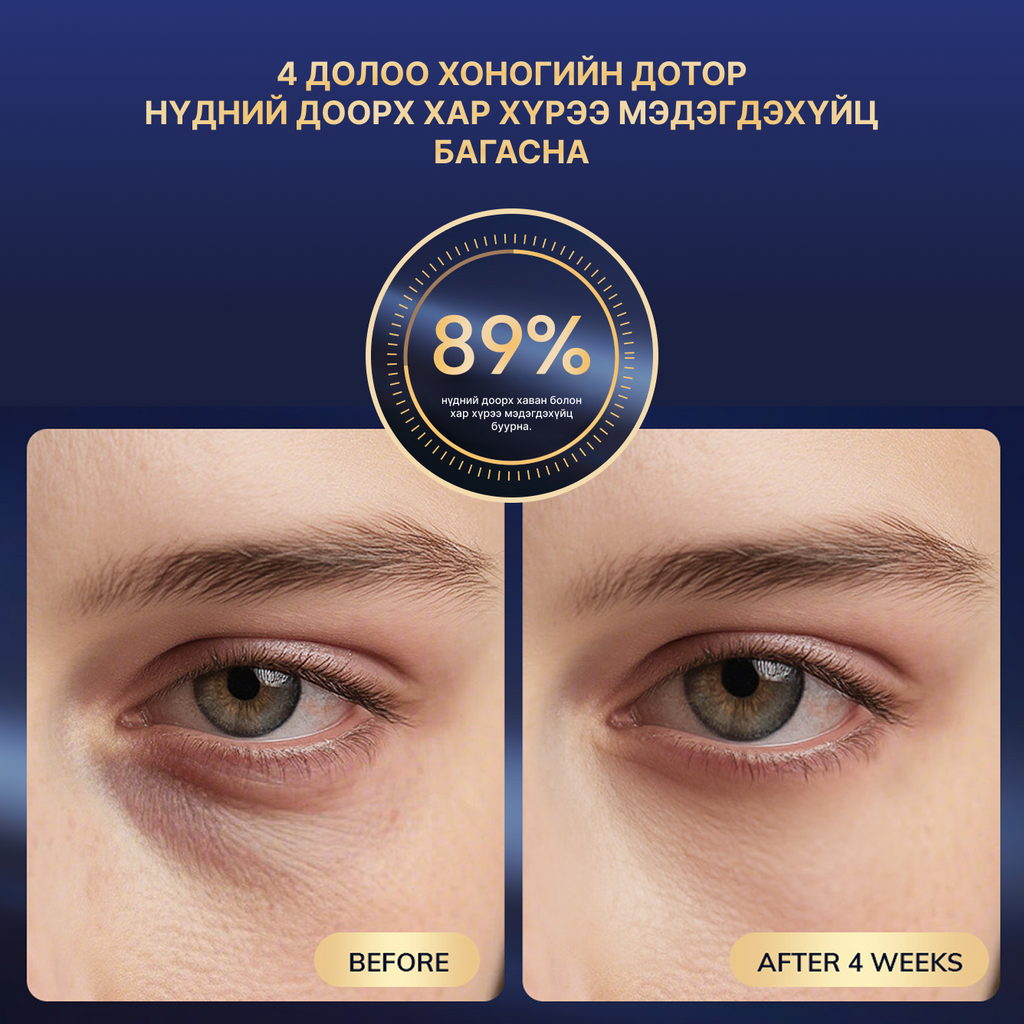 Гэрлийн эмчилгээтэй нүдний массажер