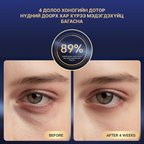 Гэрлийн эмчилгээтэй нүдний массажер