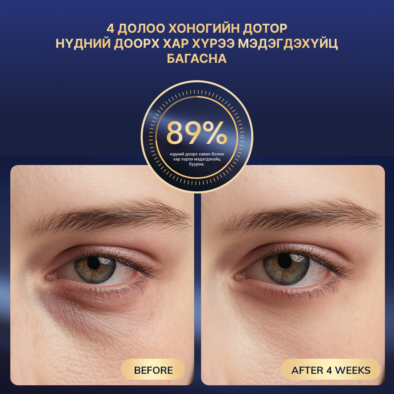 Гэрлийн эмчилгээтэй нүдний массажер