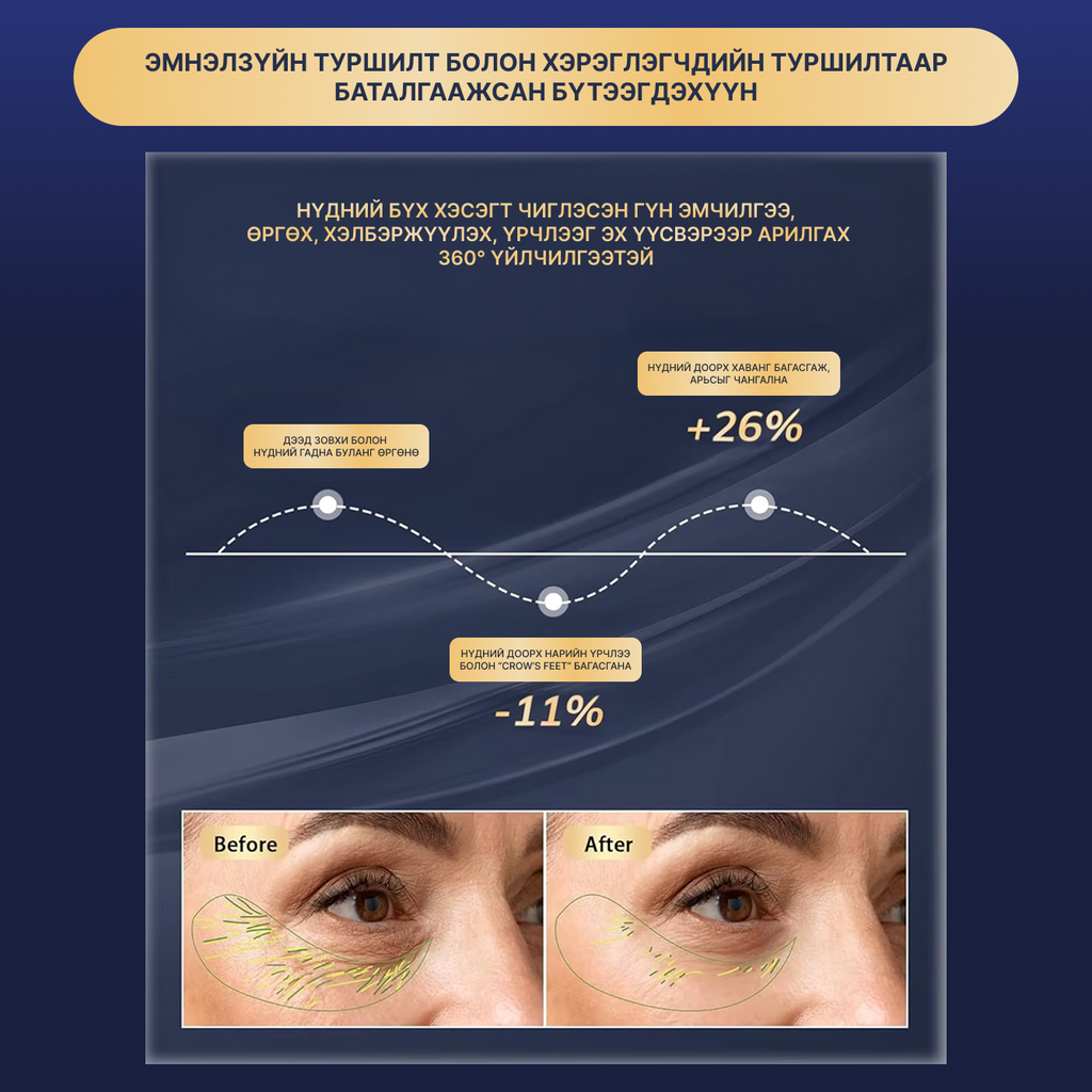 Гэрлийн эмчилгээтэй нүдний массажер