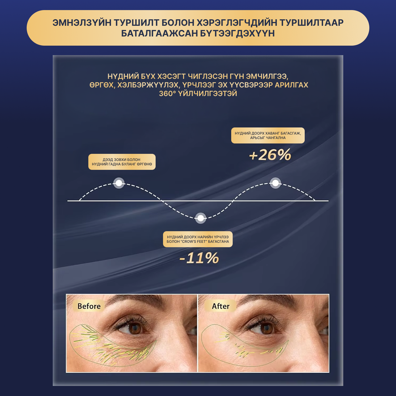 Гэрлийн эмчилгээтэй нүдний массажер